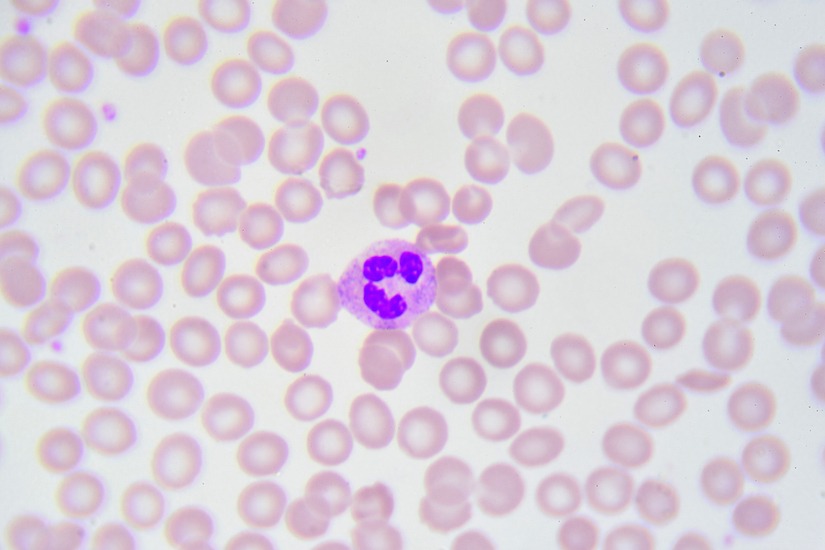 Photo of neutrophil cell