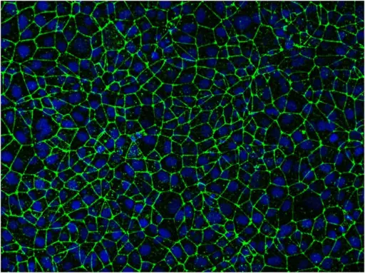 Image of blood brain barrier cells