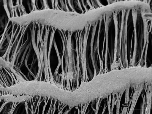Wavy microstructure of vessel 