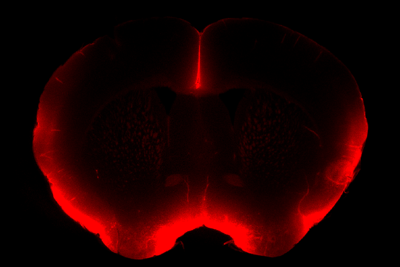 Image of mouse brain