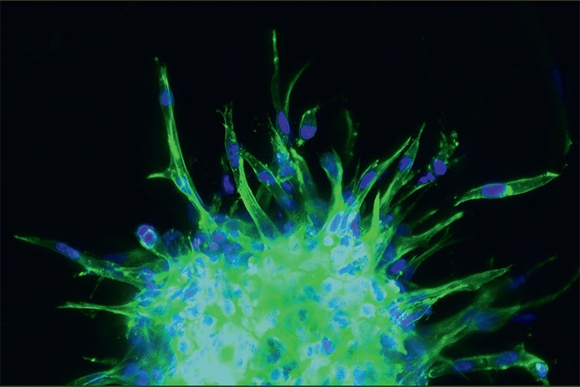 Image of breast cancer cells