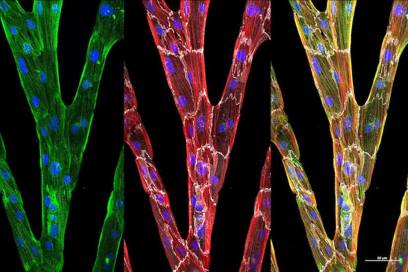 Images of individual heart cells
