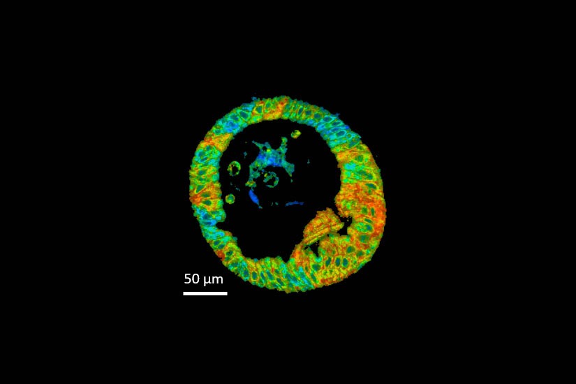 Optical metabolic imaging of a human pancreas organoid