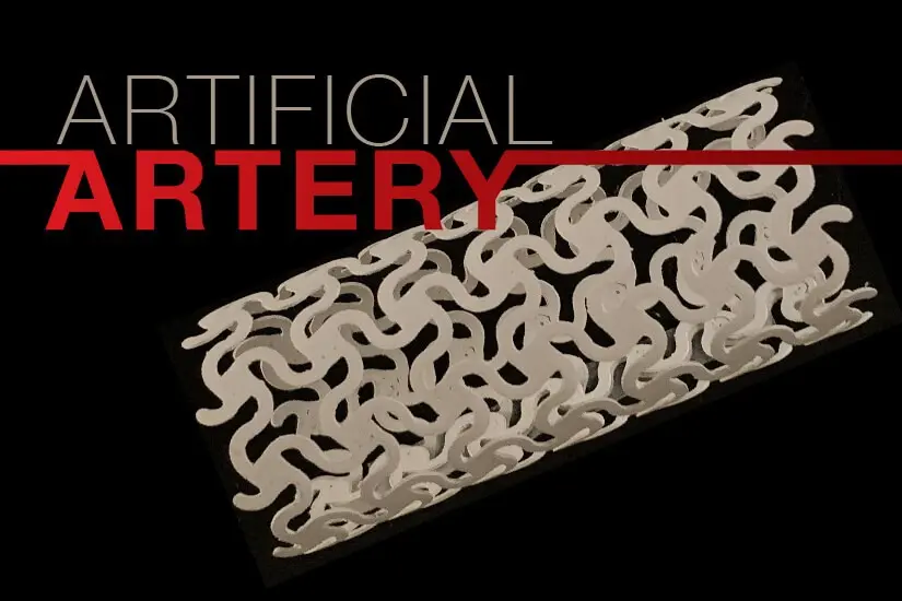 Interior design: New 3D-printed artery can monitor blockages from the ...