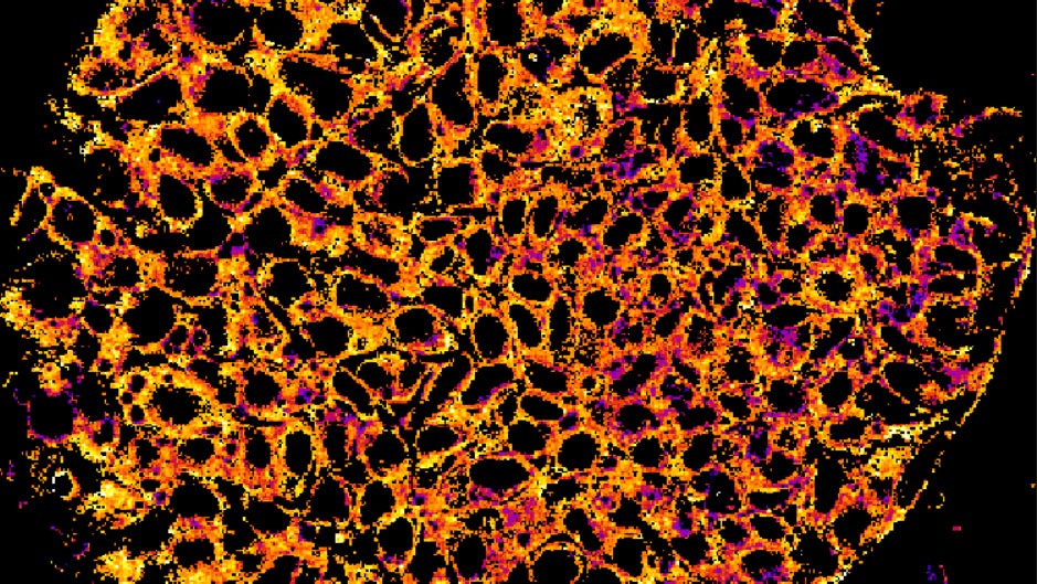 The colors in this image of induced pluripotent stem cells indicate the relative oxidation-reduction state of cells.