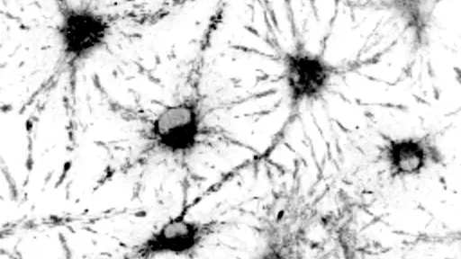 Patterns in the tiny amounts of light emitted by these neural stem cells helped researchers determine whether they were active or dormant without destructive testing.