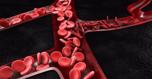 Image of supercomputer simulations of blood flow