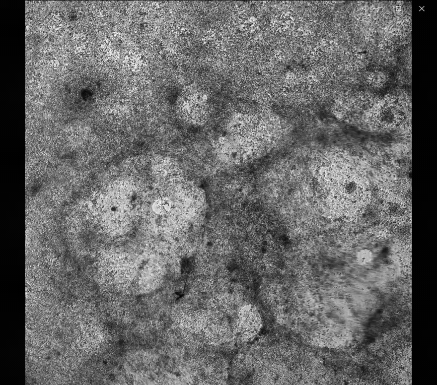 Cardiomyocyte cells beating under a microscope.