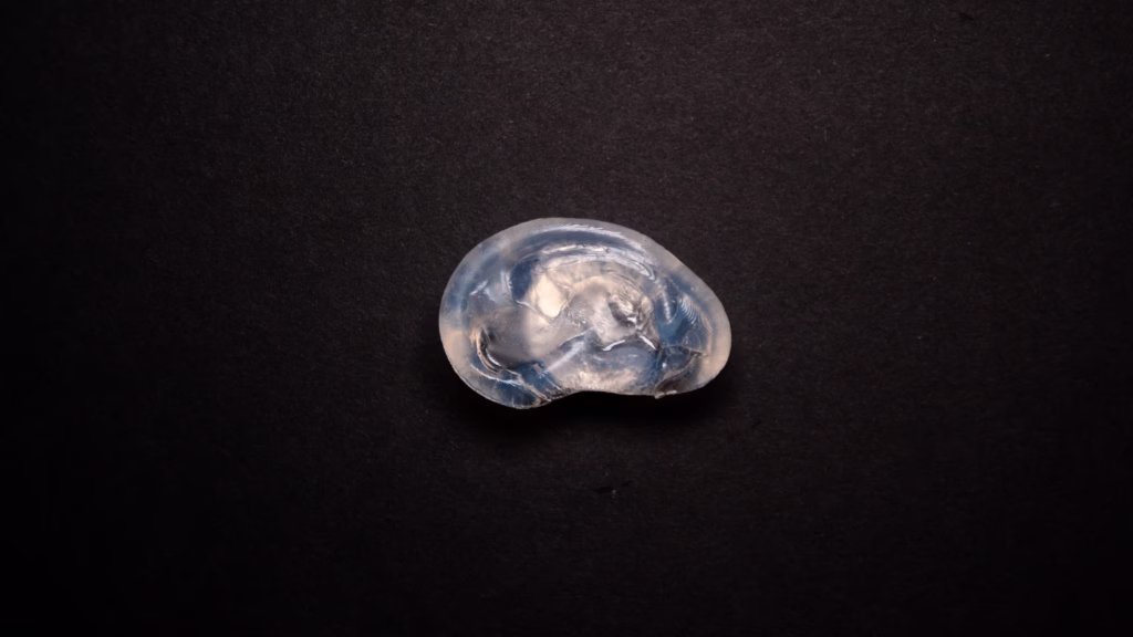 A 4D-printed hydrogel ear-shaped tissue expander