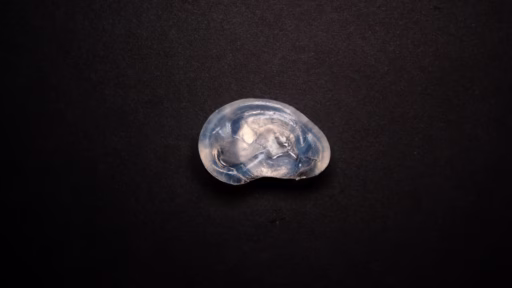 A 4D-printed hydrogel ear-shaped tissue expander