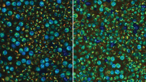 Metabolically quiescent and activated peripheral blood mononuclear cells captured with optical metabolic imaging
